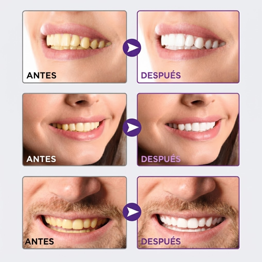 WHITEPRO™ | Sonrisa más blanca al instante desde la primera aplicación